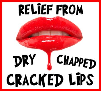 Watertown dentist, Dr. Buchholtz at Family Dental Practice, tells you how to relieve your dry, chapped, and cracked lips!