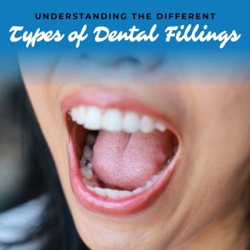 Discover the various types of dental fillings available. Learn how your Watertown dentists, Dr. William Buchholtz and Dr. Kyle Garro at Family Dental Practice, help restore smiles with personalized restorative dentistry options.