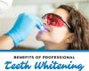 Benefits of Professional Teeth Whitening vs. DIY Kits - January 13th, 2025