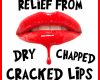 Relief from Dry, Chapped & Cracked Lips - September 13th, 2024